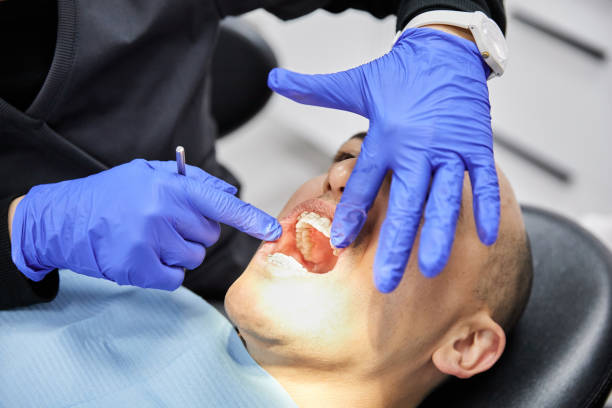 Best Emergency Broken Tooth Repair in Huachuca City, AZ